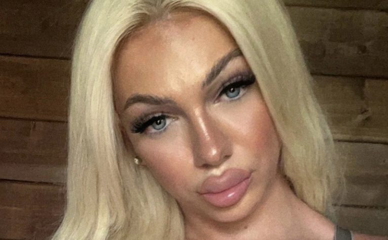 Seiska: Jade Nyström myöntää huulitäytteiden menneen överiksi: ”En käsitä, miksi helvetissä tein niin!”